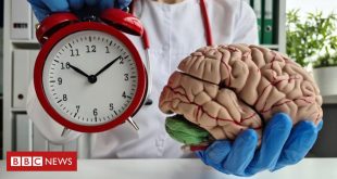 alzheimer-precoce:-os-sintomas-de-versao-da-doenca-que-pode-aparecer-a-partir-dos-30-anos