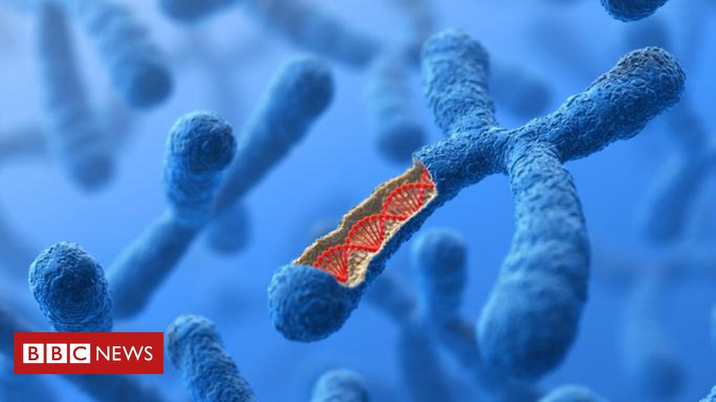 sindrome-de-patau:-sintomas-e-tratamentos-de-doenca-genetica-rara