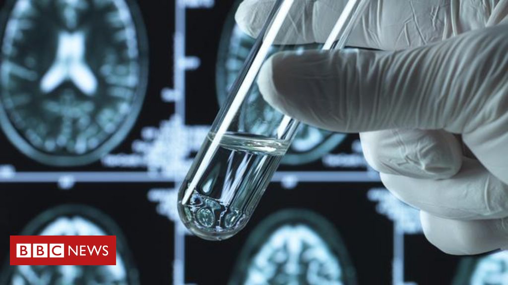 alzheimer:-uma-noticia-boa-e-tres-preocupacoes-sobre-os-novos-remedios