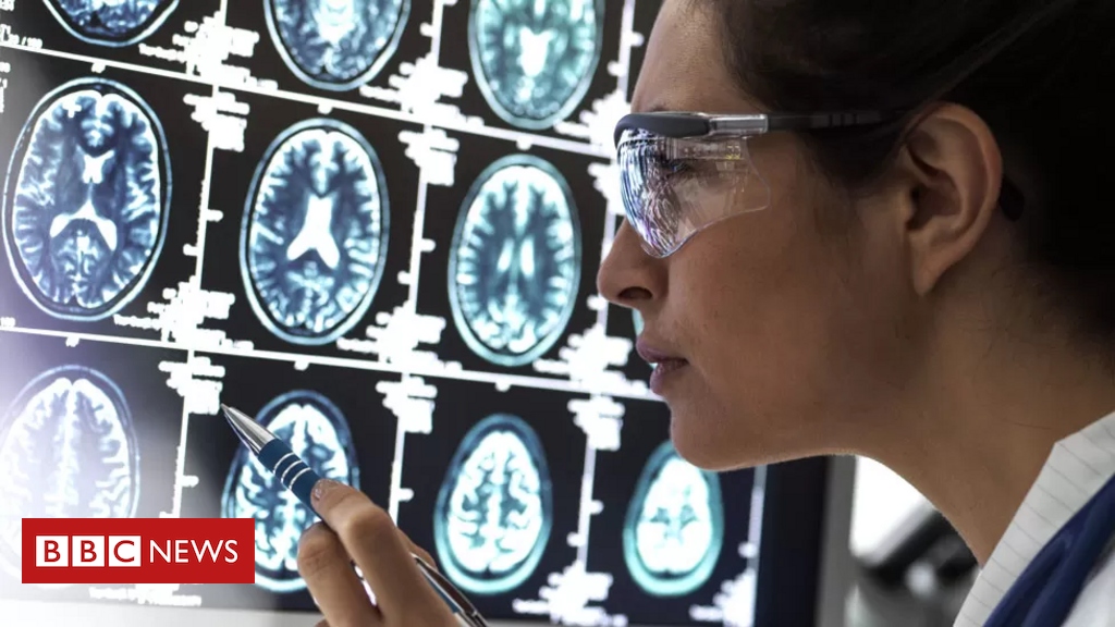 cientistas-podem-ter-desvendado-enigma-de-como-alzheimer-‘mata’-neuronios