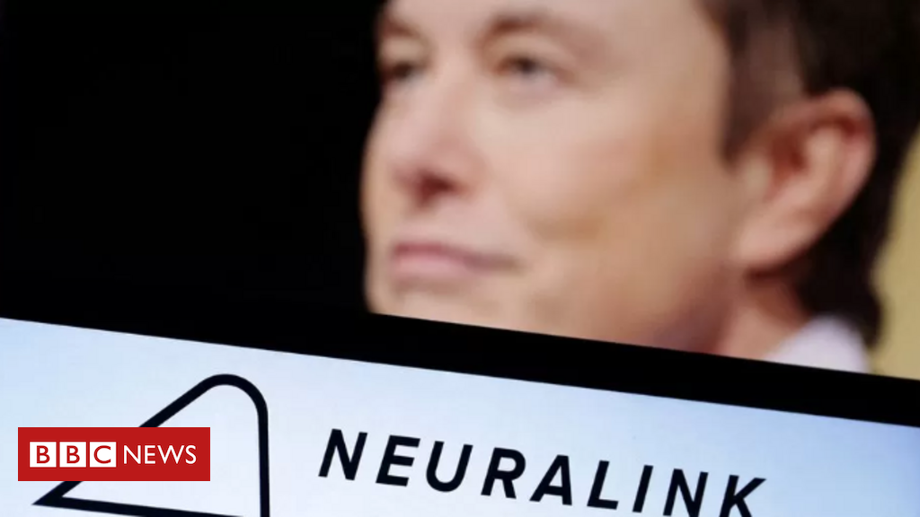 empresa-de-musk-busca-voluntarios-para-testes-com-implante-cerebral-contra-paralisia