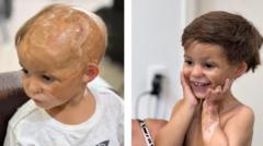 o-projeto-que-recupera-a-autoestima-de-criancas-que-perderam-o-cabelo-em-acidentes