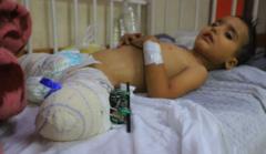 crianca-ferida,-familia-sem-sobreviventes:-a-triste-situacao-de-centenas-de-criancas-que-ficaram-orfas-em-gaza