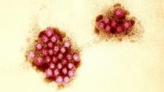 o-acaso-genetico-que-protege-alguns-do-‘virus-do-vomito’-e-pode-ajudar-a-desenvolver-vacina