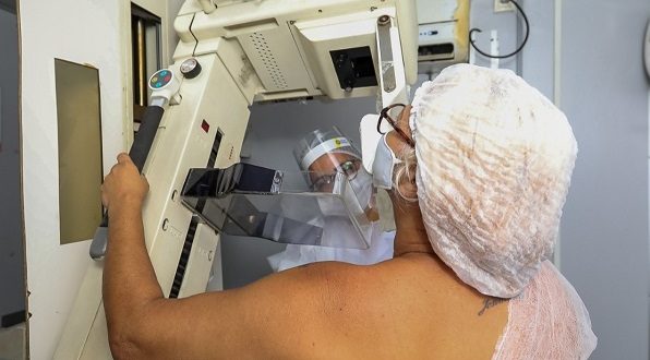 prefeitura-do-jaboatao-divulga-agenda-do mamografo movel-para-o-mes-de-junho
